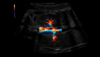 Ultrasound image of aorta and kidneys captured using Radiantflow