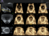 Tomographic ultrasound view of the pelvic floor showing multiple sequential slices used for SonoPelvicFloor assessment.