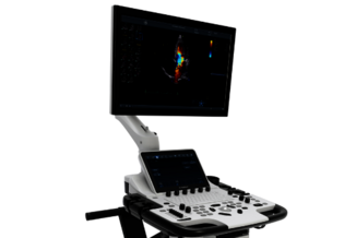 Vivid T9 ultrasound system