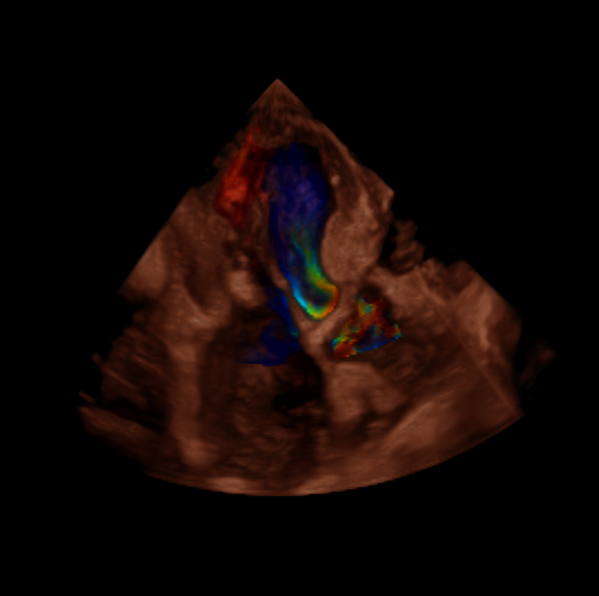 Klinický snímek zachycený pomocí funkce HD Color
