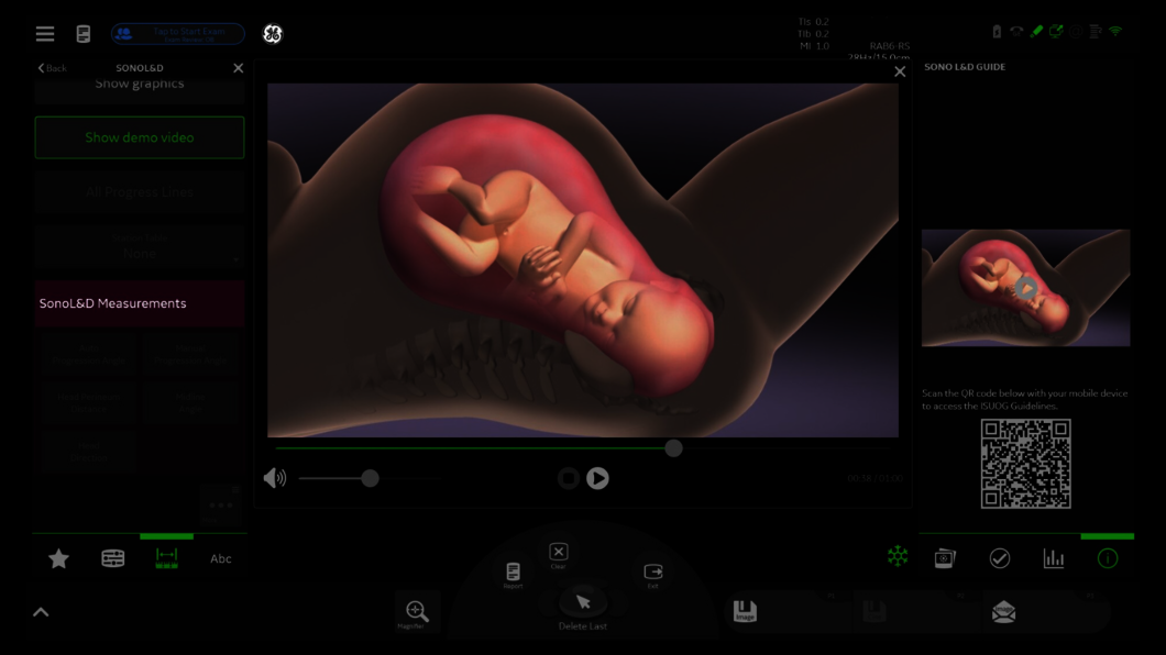 Ultrasound image Sono LD