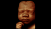 Ultrasound image of a 28-week fetal face captured with HDlive