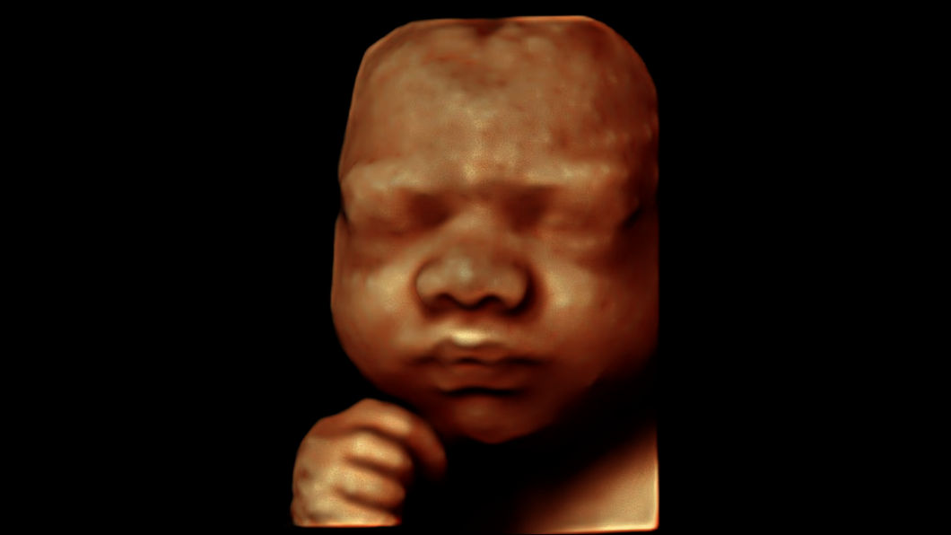 Ultraschallbild eines Fötusgesichts in der 28. Schwangerschaftswoche, aufgenommen mit HDlive
