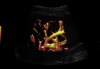 Liver ultrasound image
