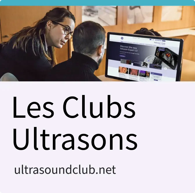 Club Ultrasons GE HealthCare