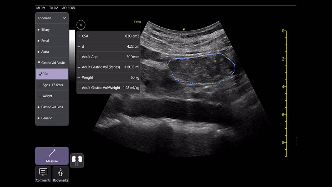 Gastric Measurement outil