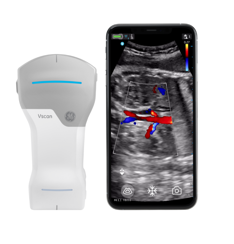 Vscan Air handheld ultrasound next to a smartphone