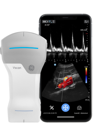 Vscan Air™ CL