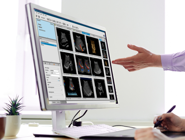 A hand is pointing on a computer screen that shows the interface of ViewPoint 6 ultrasound reporting software.