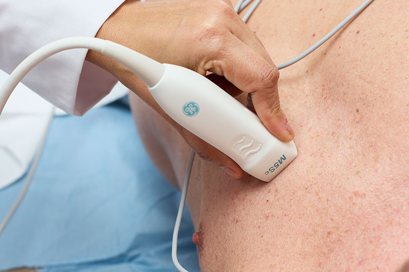 Close-up of a medical professional's hand holding a GE M5Sc ultrasound probe against a patient's bare chest.
