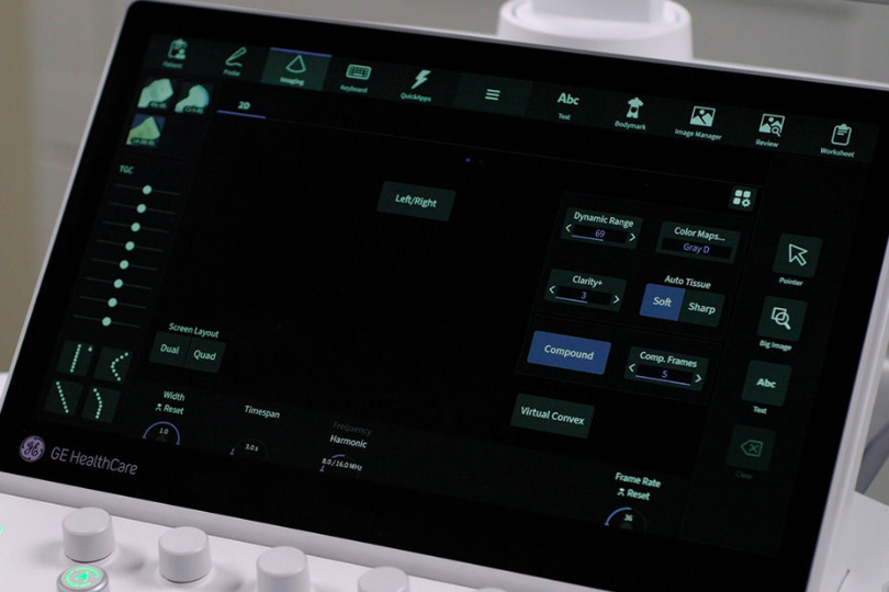 A close-up view of the GE Healthcare ultrasound system's touch-screen control panel, displaying digital imaging settings above physical adjustment knobs.