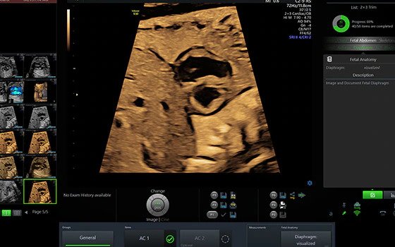 Ultrasound image captured using Scan Assistant